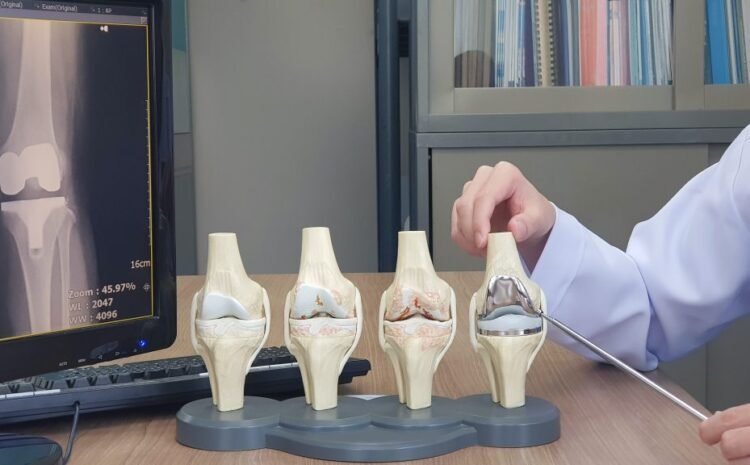  Total Knee & Hip Replacement in Thane: Recovery Timeline, Benefits & What Patients Can Expect in 2025