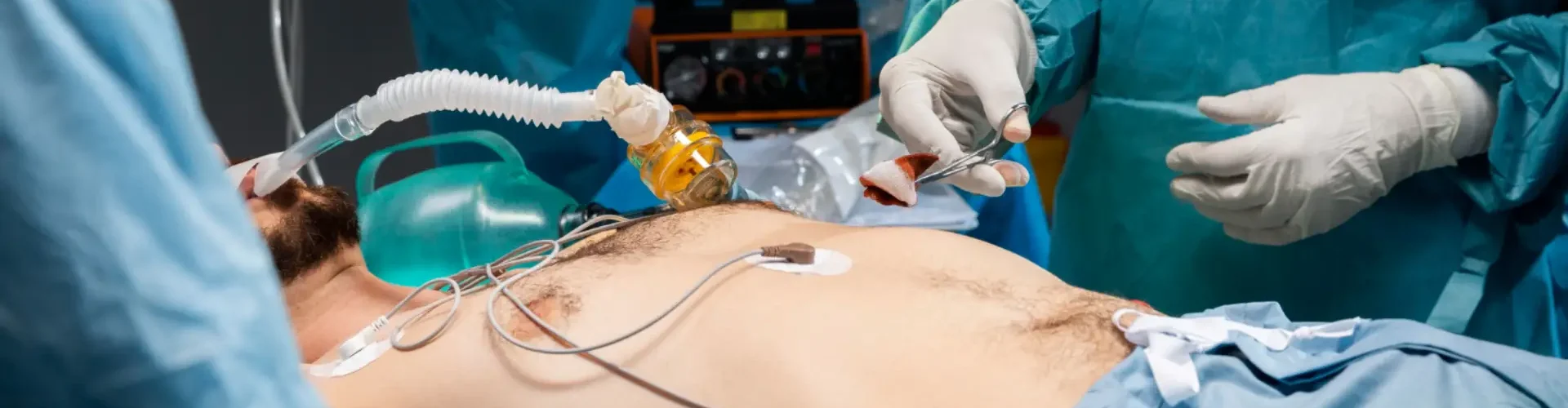 Cardiothoracic Surgery