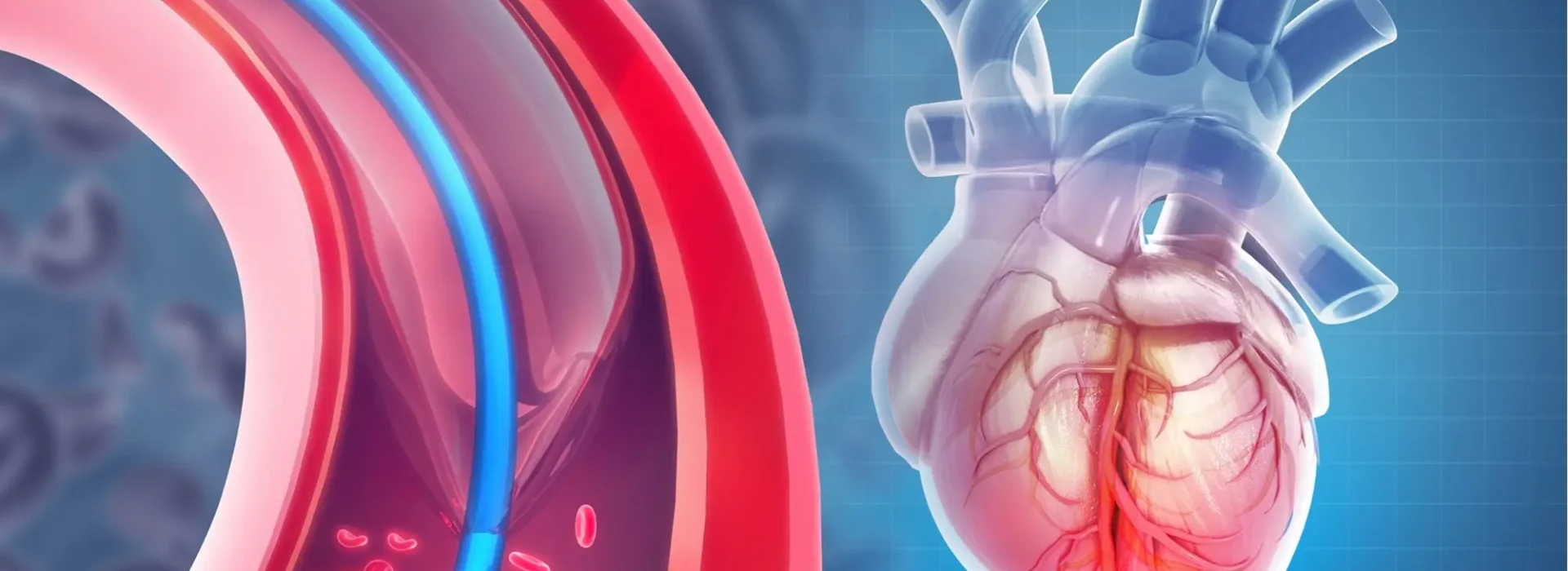 Interventional Cardiology & Angioplasty in Thane | Stellars